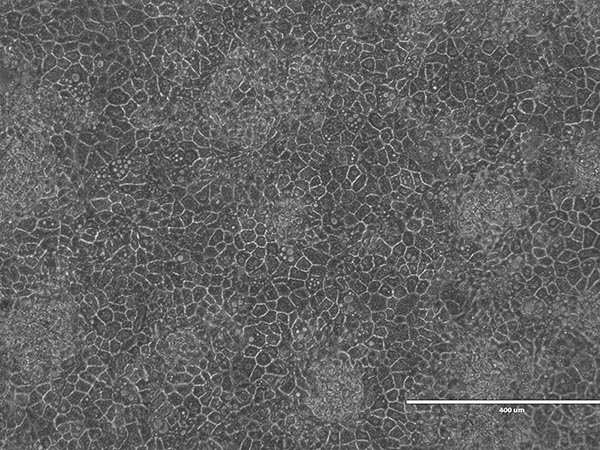 A1ATD Cell morphology