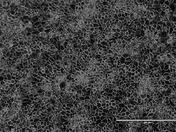 DefiniGEN_Hepatocyte_WT_cell_morphology_P7PTZoO