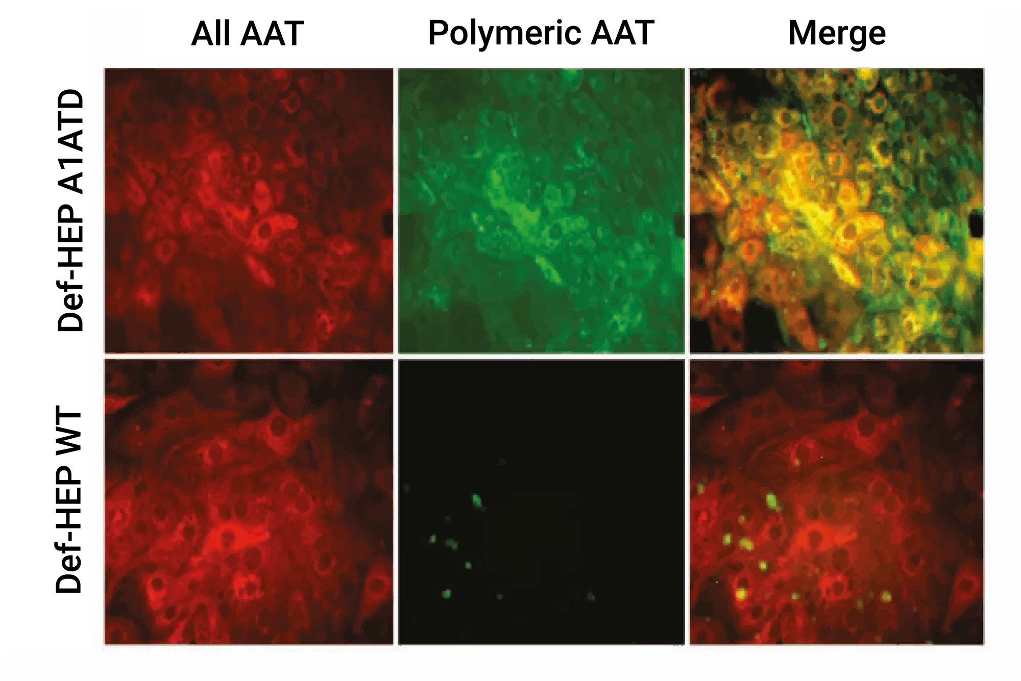 DefiniGEN_Immunocytochemistry_A1AT_mutant_Polymer