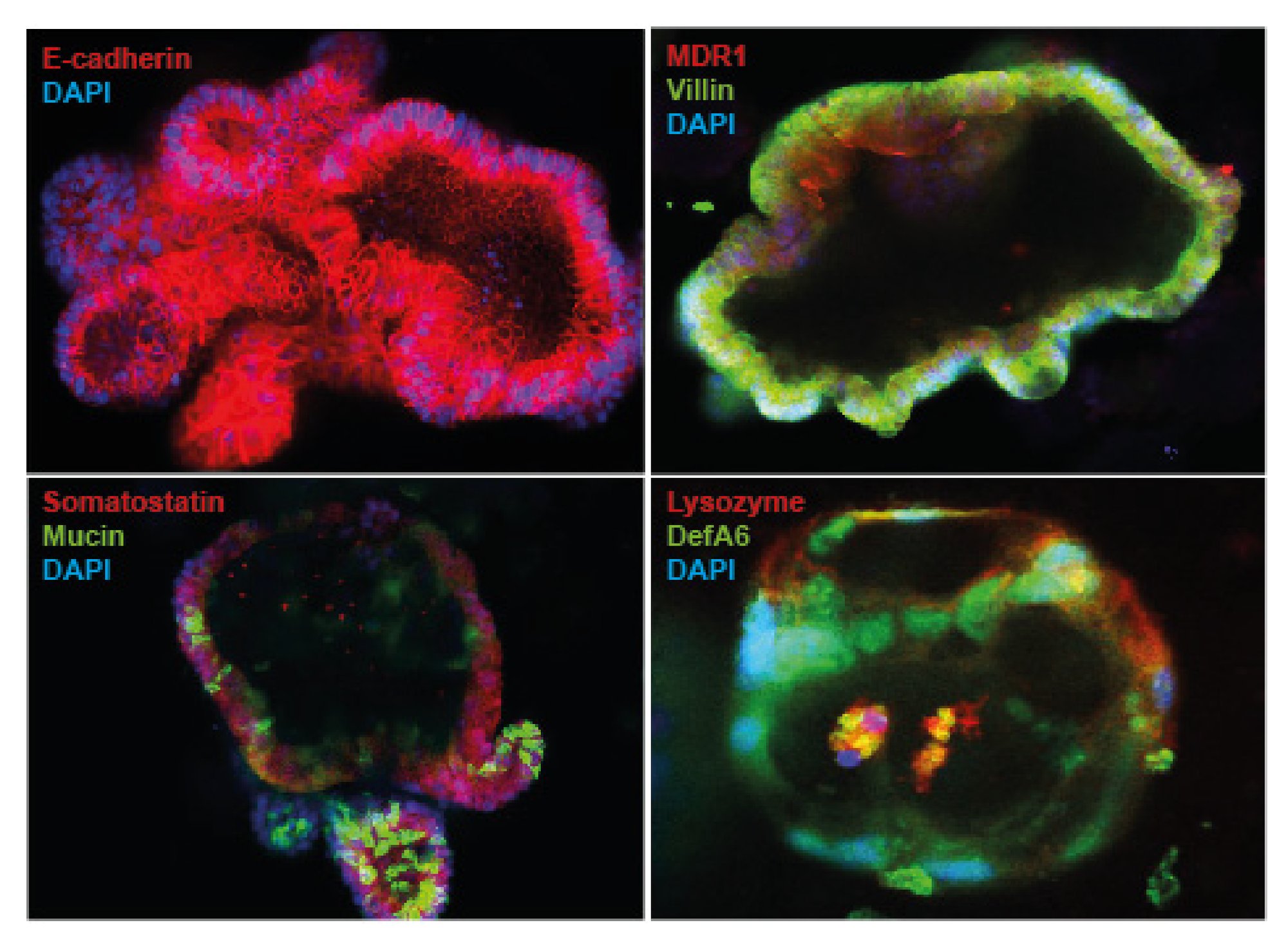 Human Intestinal Organoids Ipsc Derived Products Definigen