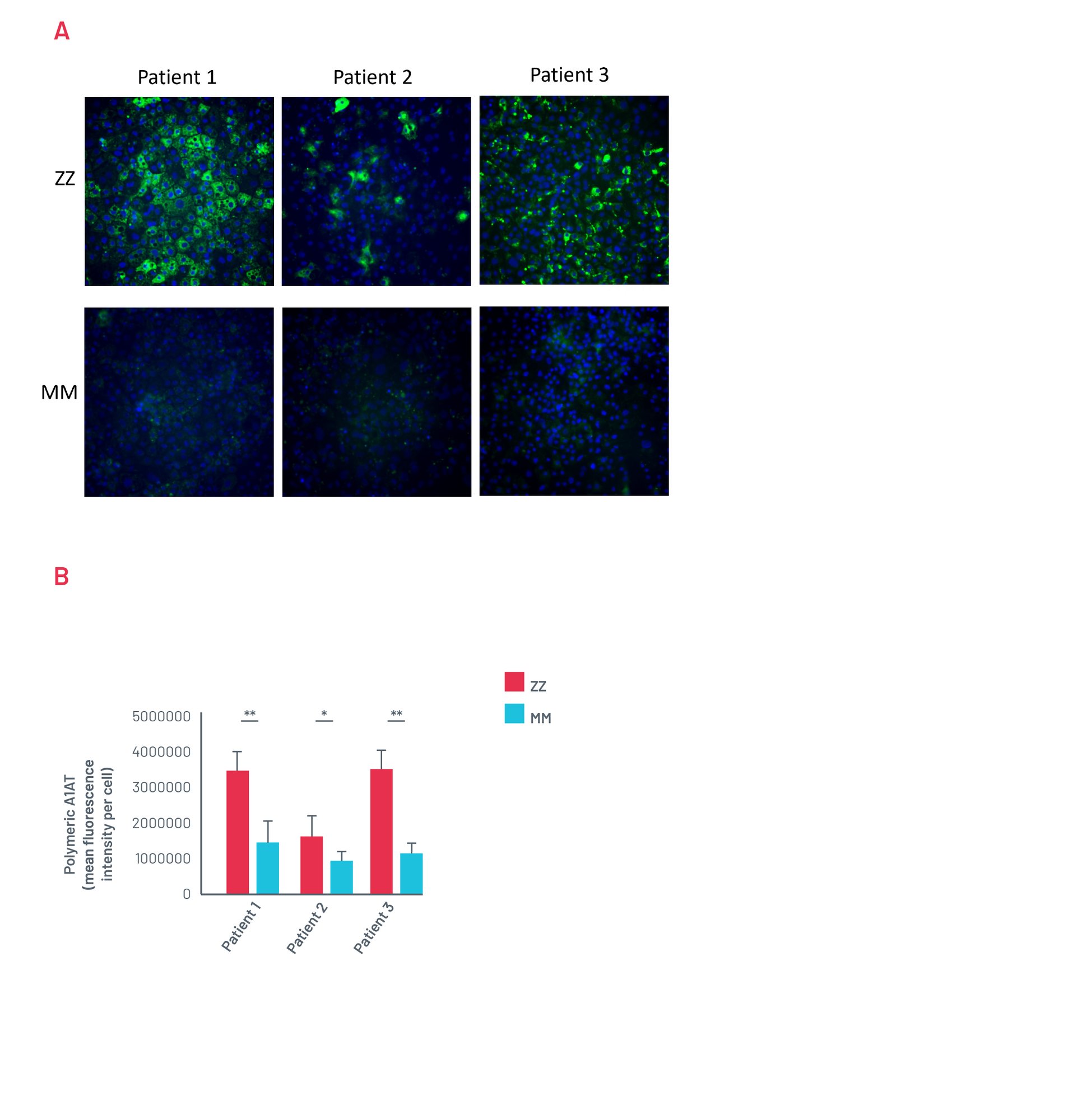 Figure 13. A1ATD Case Study