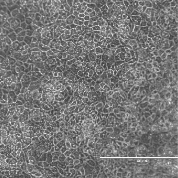 DefiniGEN A1AT disease modelled hepatocytes morphology_Cell_Product_Image_600x600