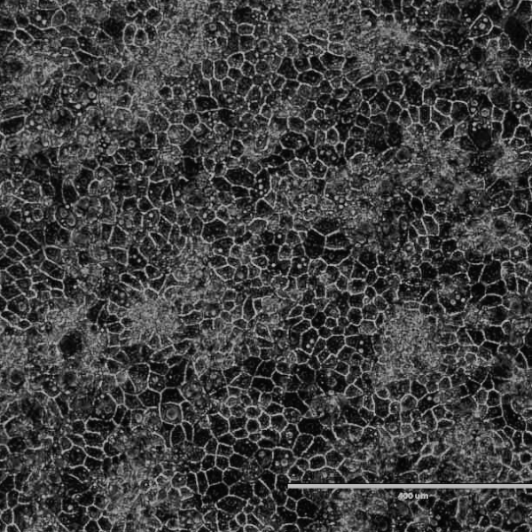 DefiniGEN hepatocyte wt cell morphology_Cell_Product_Image_600x600