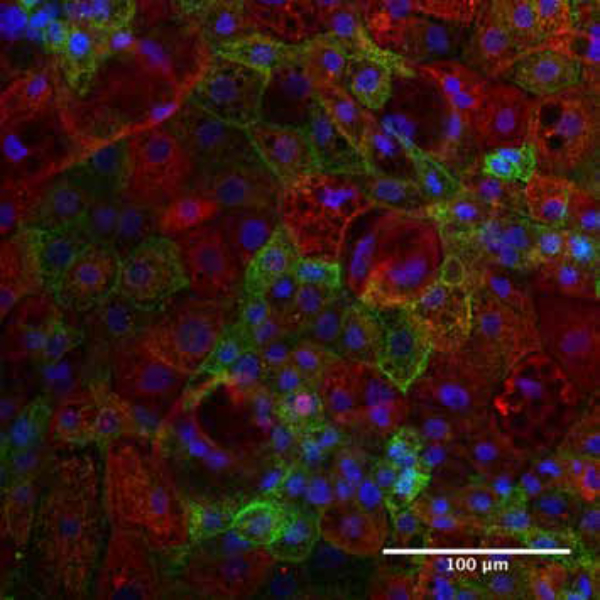 DefiniGEN_Hep_NAFLD_Cell_Product_Image_600x600