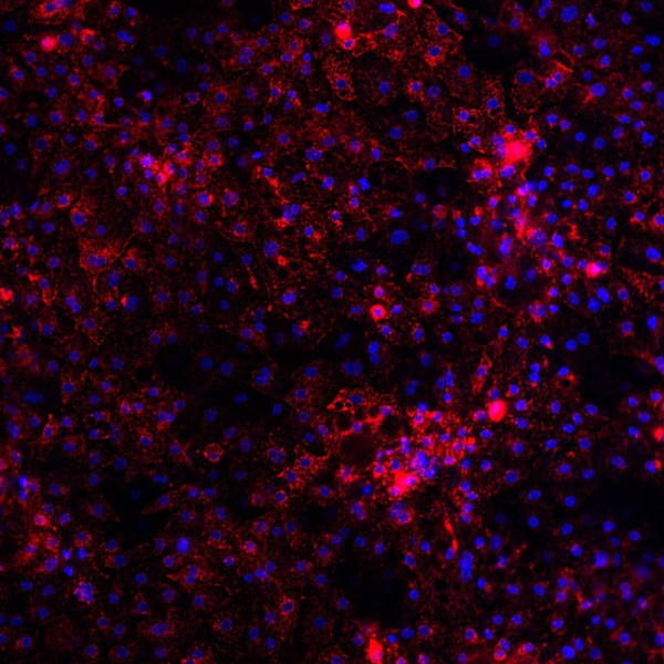 DefiniGEN_Wilsons Disease (RGB)_Cell_Product_Image_600x600